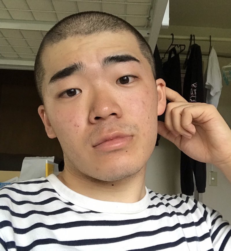 若はげ 坊主 若はげ 坊主
