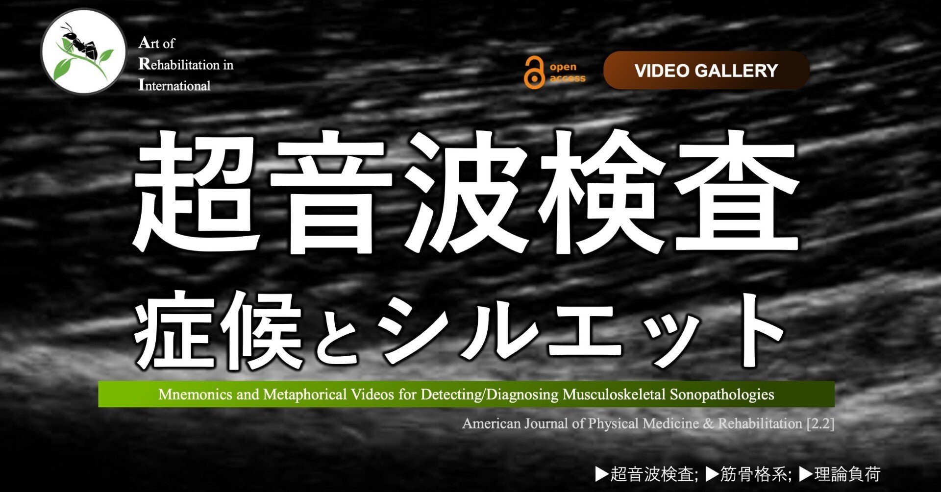 超音波検査。症候とシルエット｜Super Human | 理学療法士／保健