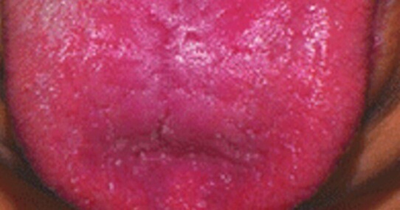 いつ医師の助けを求めるべきか