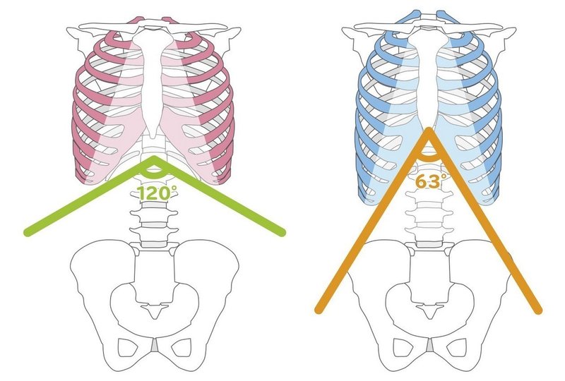 ウエストのくびれを骨格から細くして作る 姿勢分析師 高松 Note ウエストのくびれを骨格から細くして作る 姿勢分析師 高松 Note