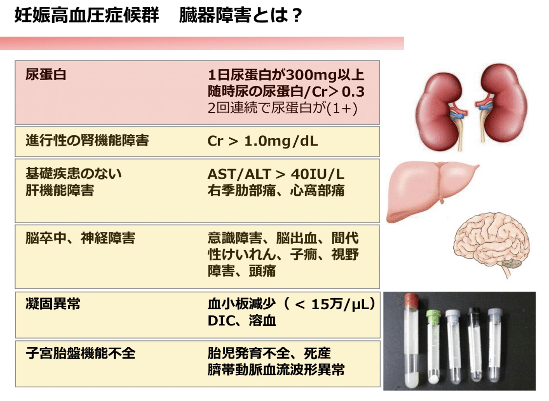 合併症妊娠 o1280072015018023123.png