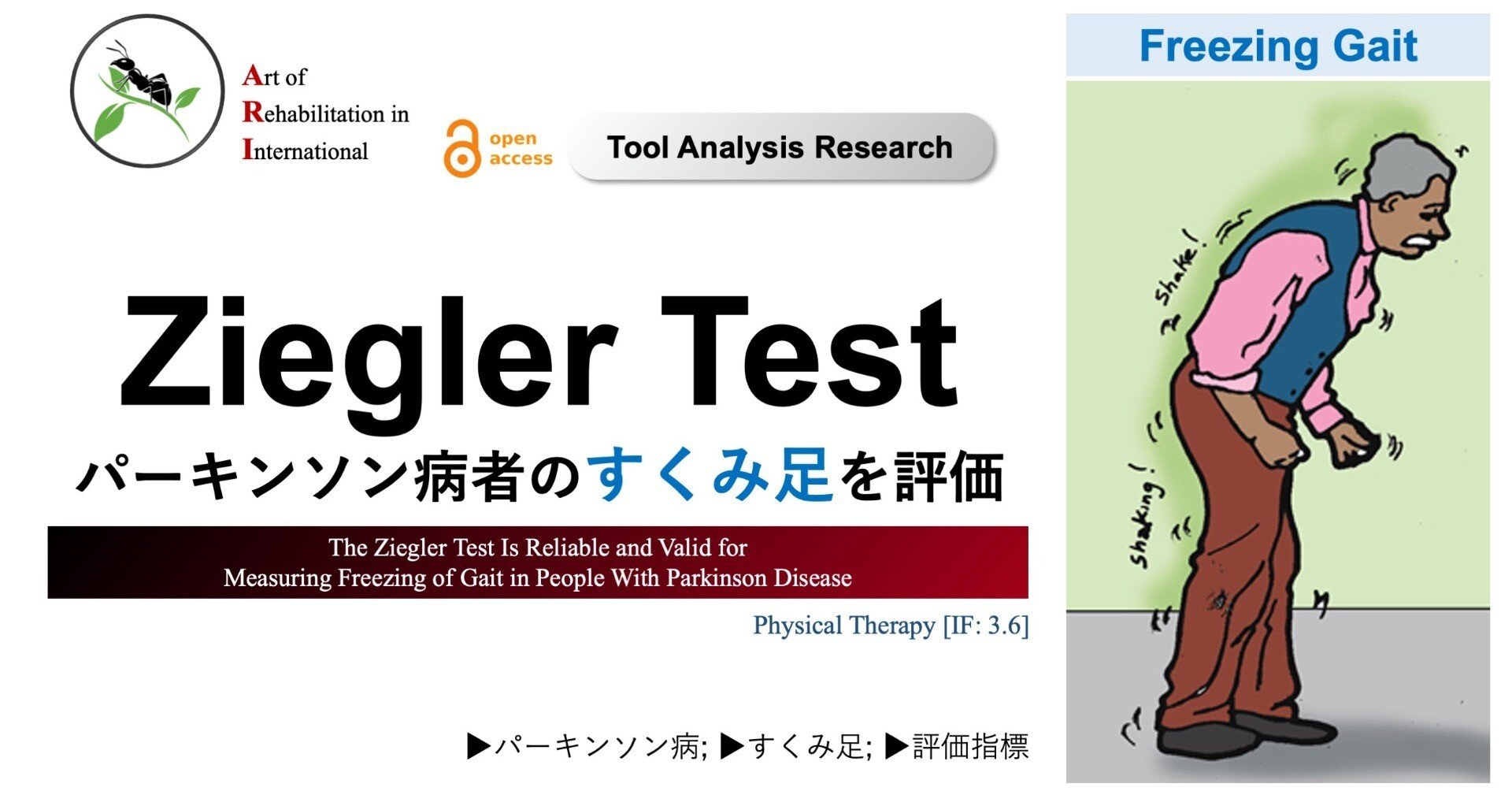 Ziegler Test。パーキンソン病者のすくみ足を評価｜Super Human
